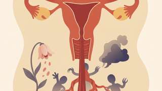 月经连续不断正常吗？警惕这3个幕后黑手，别等贫血了才后悔